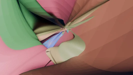 kivqoucochlea.webp